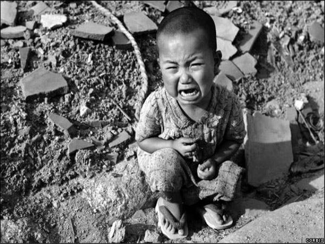 Fotos das vitimas da bomba atomica 30 Fotos das vitimas da bomba atomica 75